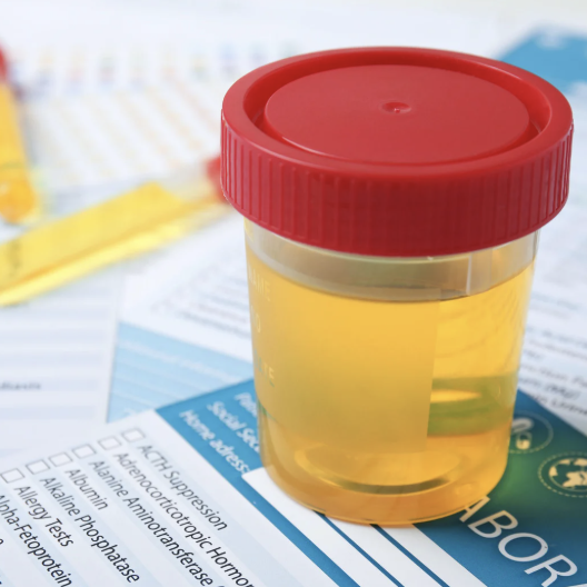 Drug and Alcohol Screening (Owasso)